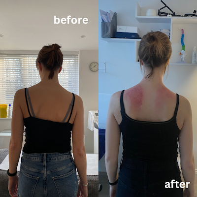 Revive Sports Massage · Photos 15